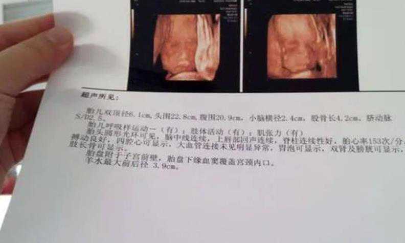 武汉助孕中心咨询 在武汉做一次试管婴儿费用明细 ‘32周双顶径看男女’